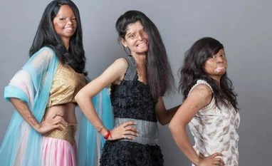 Acid attack victims to get reservation in govt jobs, promotions Photo: Rahul Saharan