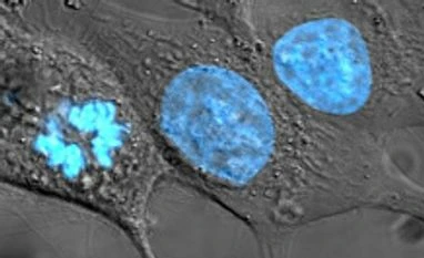 DNA may predict when and how we're going to die DNA