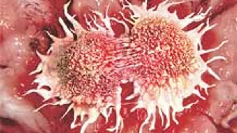 New method to trap cancer cells before they spread New method to trap cancer cells before they spread