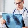 New rapid TB tests could reduce mortality
