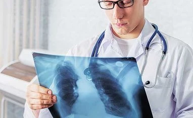 Want to end TB? Diagnose and treat all forms of the disease Tuberculosis