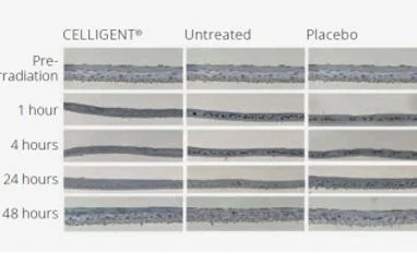 Cosmetic actives: A helping hand for sun care products Figure 2 (Lower panel): Active DNA protection upon solar irradiation