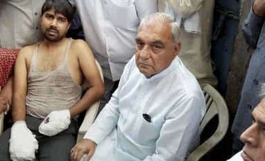 Haryana recommends CBI probe into Dalit toddlers' killing Former CM Haryana Bhupender Singh Hooda and MLA Karan Dalal meets injured Jitender after his house was set on fire by some dominant people at Ballabgarh in Faridabad