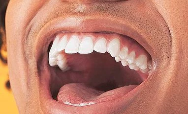 Speech and Language Therapy for Children Fit & Proper: The heart-and-mouth connection