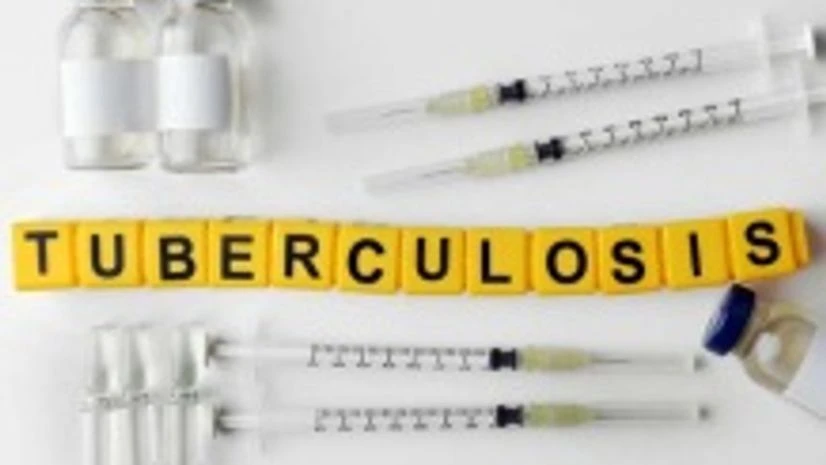 Doctors advocate better diagnostic algorithms to fight multi drug resistant TB Doctors advocate better diagnostic algorithms to fight multi drug resistant TB
