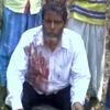 One CPI(M) supporter injured in clashes between TMC and CPI(M) workers in Arambag, Hooghly. Photo: ANI