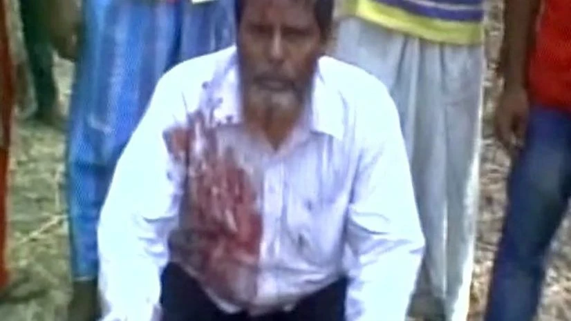 One CPI(M) supporter injured in clashes between TMC and CPI(M) workers in Arambag, Hooghly. Photo: ANI One CPI(M) supporter injured in clashes between TMC and CPI(M) workers in Arambag, Hooghly. Photo: ANI