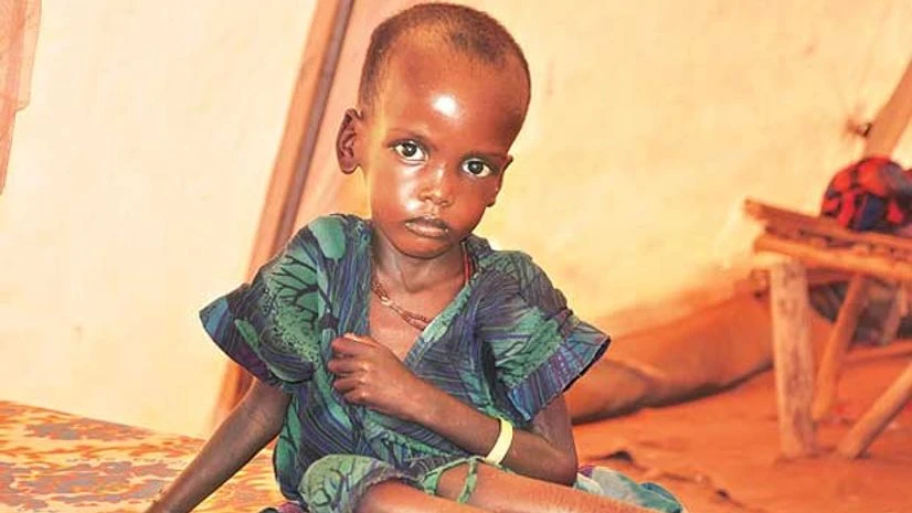 Defects in immune system linked to malnutrition Defects in immune system linked to malnutrition