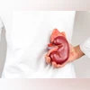 Image via Shutterstock Kidney