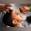 Govt allays concerns on polio; says India remains polio-free Govt allays concerns on polio; says India remains polio-free