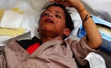 IS suicide bomber kills 71 army recruits in Yemen An injured child who survived the attack. Photo courtesy: Twitter user Hisham Al-Omeisy