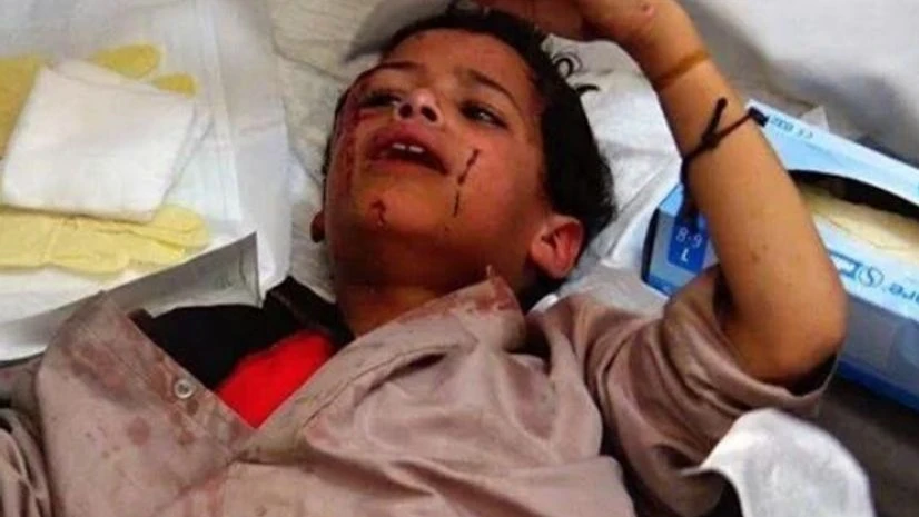 An injured child who survived the attack. Photo courtesy: Twitter user Hisham Al-Omeisy An injured child who survived the attack. Photo courtesy: Twitter user Hisham Al-Omeisy