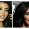 Kim Kardashian in 2008 and in 2016; the American celebrity is reported to have used the ‘vampire facelift’