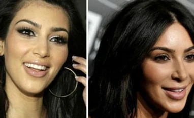 The look of vengeance Kim Kardashian in 2008 and in 2016; the American celebrity is reported to have used the ‘vampire facelift’