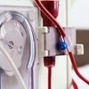 Dialysis