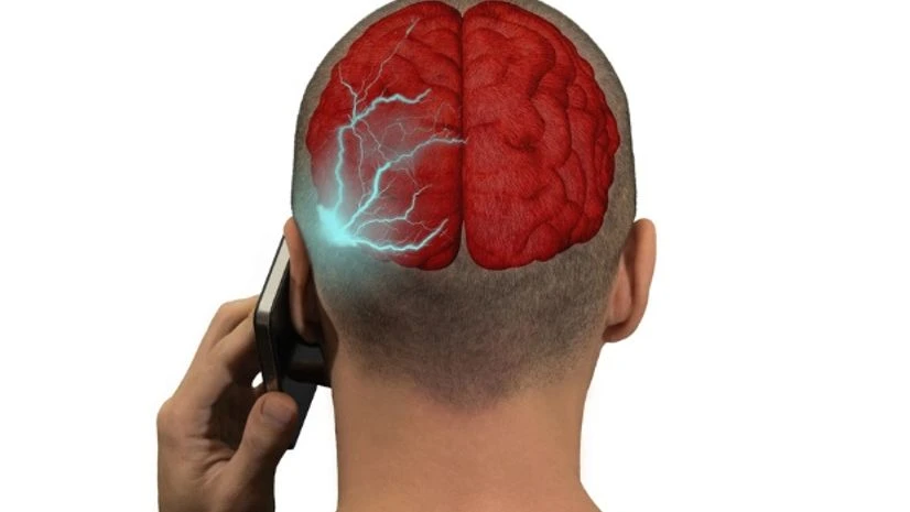 brain, mobile, radiation brain, mobile, radiation