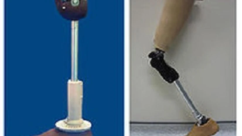 Prosthetic limbs, limbs Prosthetic limbs, limbs