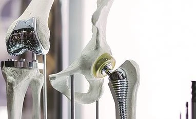 Govt asks firms to maintain knee implant supplies at level before price cap bones, orthopaedic, orthopaedic implant, bone,