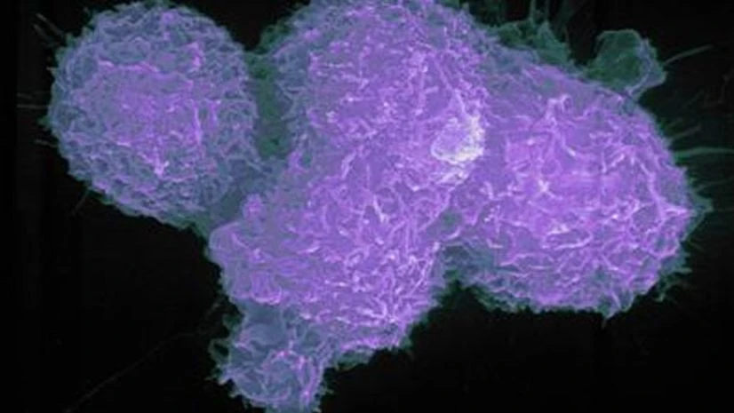 This microbot can capture cells like a tiny Pac-Man, may help probe cancer This microbot can capture cells like a tiny Pac-Man, may help probe cancer