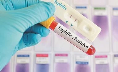 Sex, drugs and the return of syphilis syphilis
