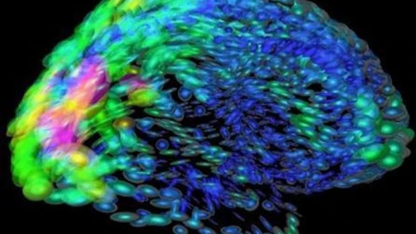 Schizophrenia Schizophrenia