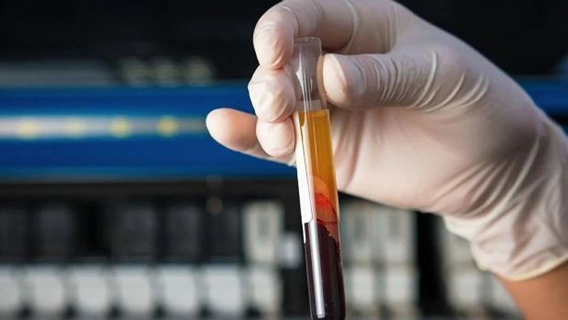 Chip-based cancer test may replace painful bone biopsy Chip-based cancer test may replace painful bone biopsy