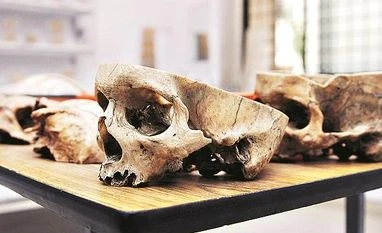 Bengaluru's Brain Museum is an experience for the curious and brave Weekend