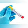 Nipah virus flares up in Kerala again: Here's what to know about symptoms | Health News Nipah virus