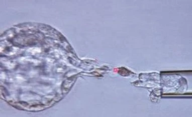 India's first babies to be born without a hereditary cancer-causing gene weekend