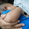 Breastfeeding