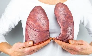 Air quality in Lucknow worse than Delhi; artificial lungs go black in a day artificial lungs, air pollution