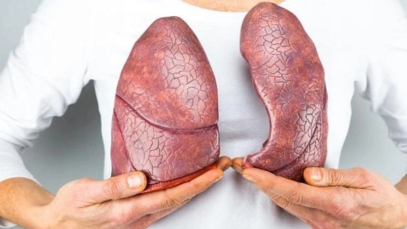 artificial lungs, air pollution artificial lungs