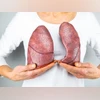 Most lung cancer patients in India are non-smokers, study reveals artificial lungs, air pollution
