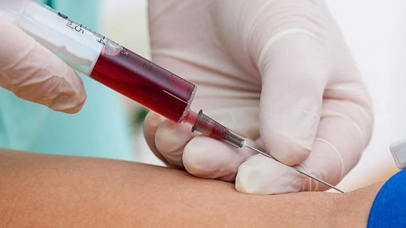 New Blood test can detect Alzheimer's 3.5 yrs before diagnosis: Scientists New Blood test can detect Alzheimer's 3.5 yrs before diagnosis: Scientists