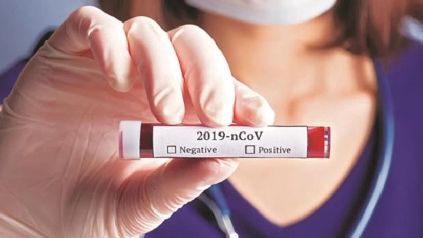 coronavirus, test coronavirus, test