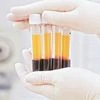 icmr, testing, test, plasma therapy, research, blood, clinics, laboratory, labs