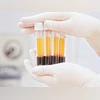 icmr, testing, test, plasma therapy, research, blood, clinics, laboratory, labs