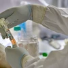 A medic works on samples collected from media professionals for COVID-19 tests, at a special testing centre set up by the Delhi government. Photo: PTI