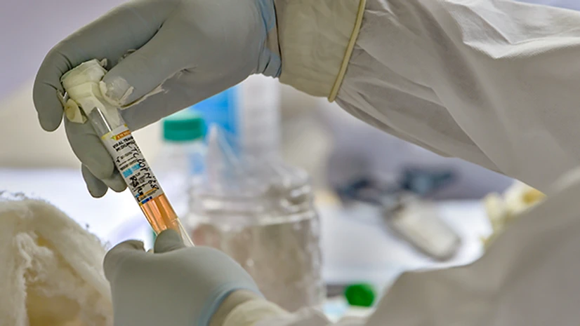 medicos, doctors, coronavirus, coronavirus tests, doctors, coronavirus, Covid-19 awareness graffiti A medic works on samples collected from media professionals for COVID-19 tests, at a special testing centre set up by the Delhi government. Photo: PTI