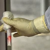 Gilead's Covid-19 cure trial may yield results ahead of schedule: Report