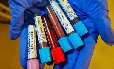 24 people in Army's RR hospital in Delhi test positive for Covid-19 Coronavirus testing, Covid-19 testing