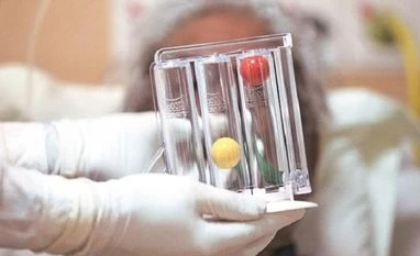 Covid-19 recoveries exceed active cases in India for the first time Coronavirus