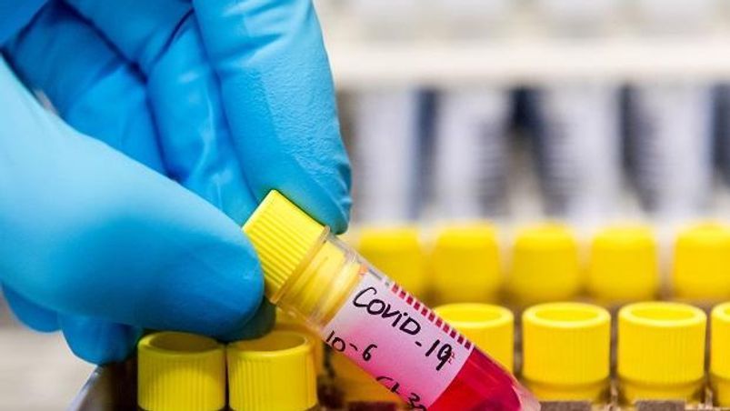 Covid-19, Coronavirus Malaysia detects new Covid-19 strain that's 10 times more infectious