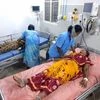 20 workers fall ill after gas leak in private agro products unit in AP