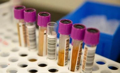 Rapid antigen tests can be no more than adjunct to RT-PCR: Scientists Coronavirus testing