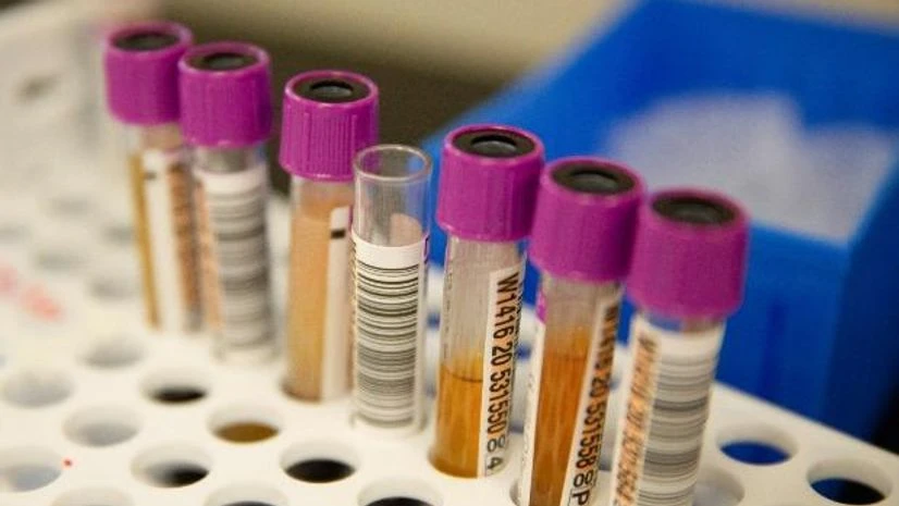 Coronavirus testing Coronavirus testing