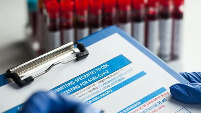 serosurvey, serological test Photo: Shutterstock