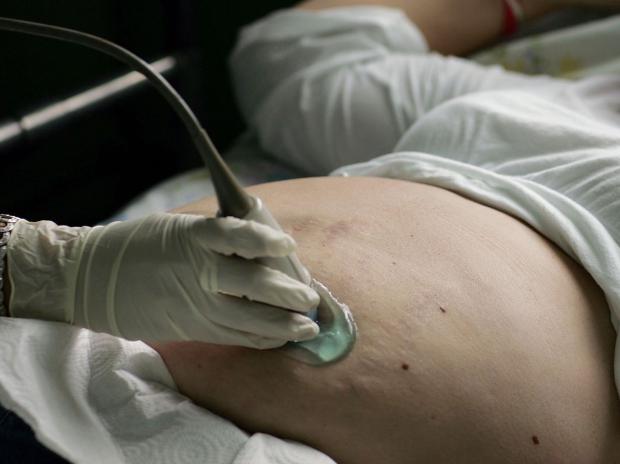 9 months after lockdowns, US births see biggest decline since 1973 9 months after lockdowns, US births see biggest decline since 1973