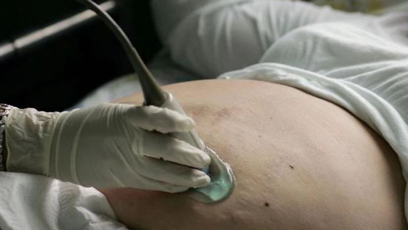 pregnancy Photo: Bloomberg