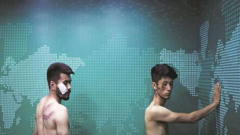 Afghan Journalists Neamat Naghdi, video reporter, and Taqi Daryabi, video editor, who both work for Etilaat Roz newspaper, were thrashed by the Taliban during incarceration. Their crime was covering women's protests in Kabul.(Photo: Reuters)